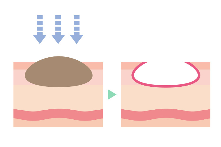 plastic_surgery画像15