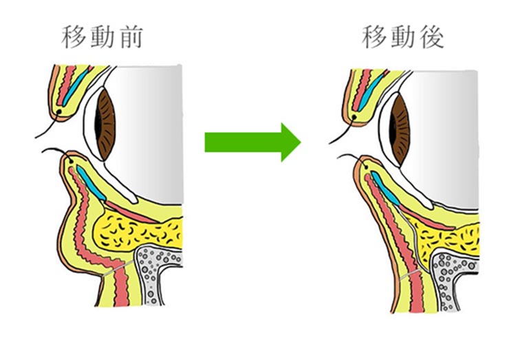 plastic_surgery画像22